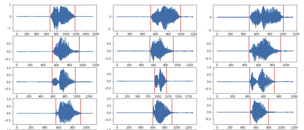 Grid with multiple time series depicting the signals + markers where we detect start/end of silence